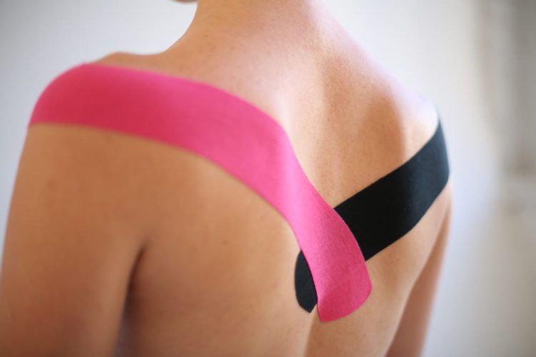 Hội chứng Cowden - Hình ảnh minh họa